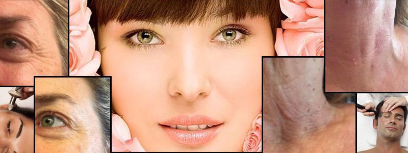 LIMPIEZA FACIAL POR ULTRASONIDOS BANNER MOURE
