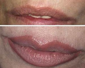 dermopigmentacion-cejas-labios-tatoo-maquillaje-permanente-428405-MLA25010906338_082016-O-300x241
