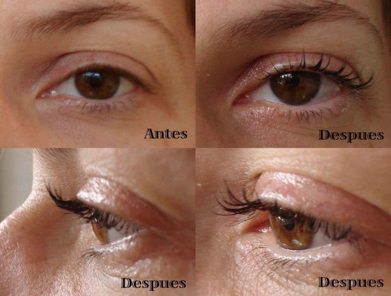 PERMANENTE Y LIFTING DE PESTAÑAS ANTES Y DESPUES