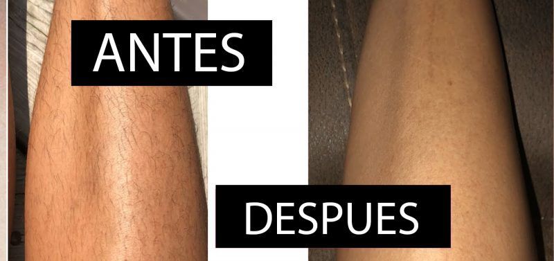 FOTODEPILACIÓN LÁSER MOURE MUJER IPL LIGHT (6)