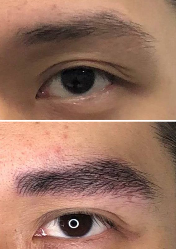 MICROPIGMENTACION DE CEJAS HOMBRE MOURE (5)
