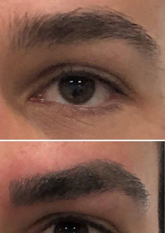 MICROPIGMENTACION DE CEJAS HOMBRE MOURE (7)