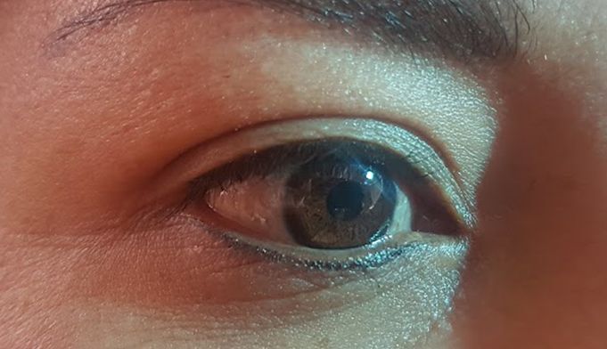 MICROPIGMENTACION DE OJOS Y PESTAÑAS MOURE ANTES Y DESPUES (5)