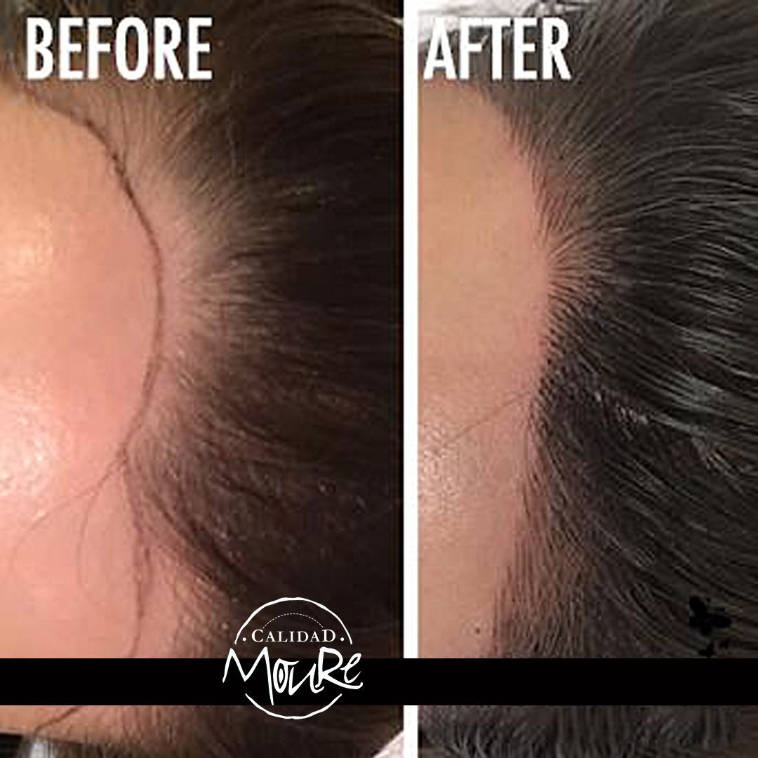 MICROPIGMENTACION MUJER MOURE MAS DENSIDAD PELO LARGO (10)