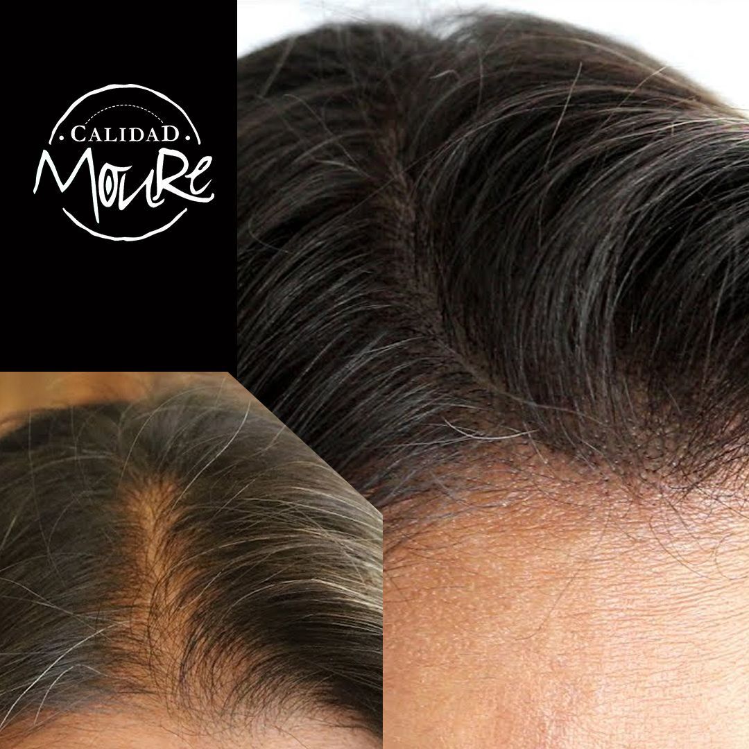 MICROPIGMENTACION MUJER MOURE MAS DENSIDAD PELO LARGO (14)