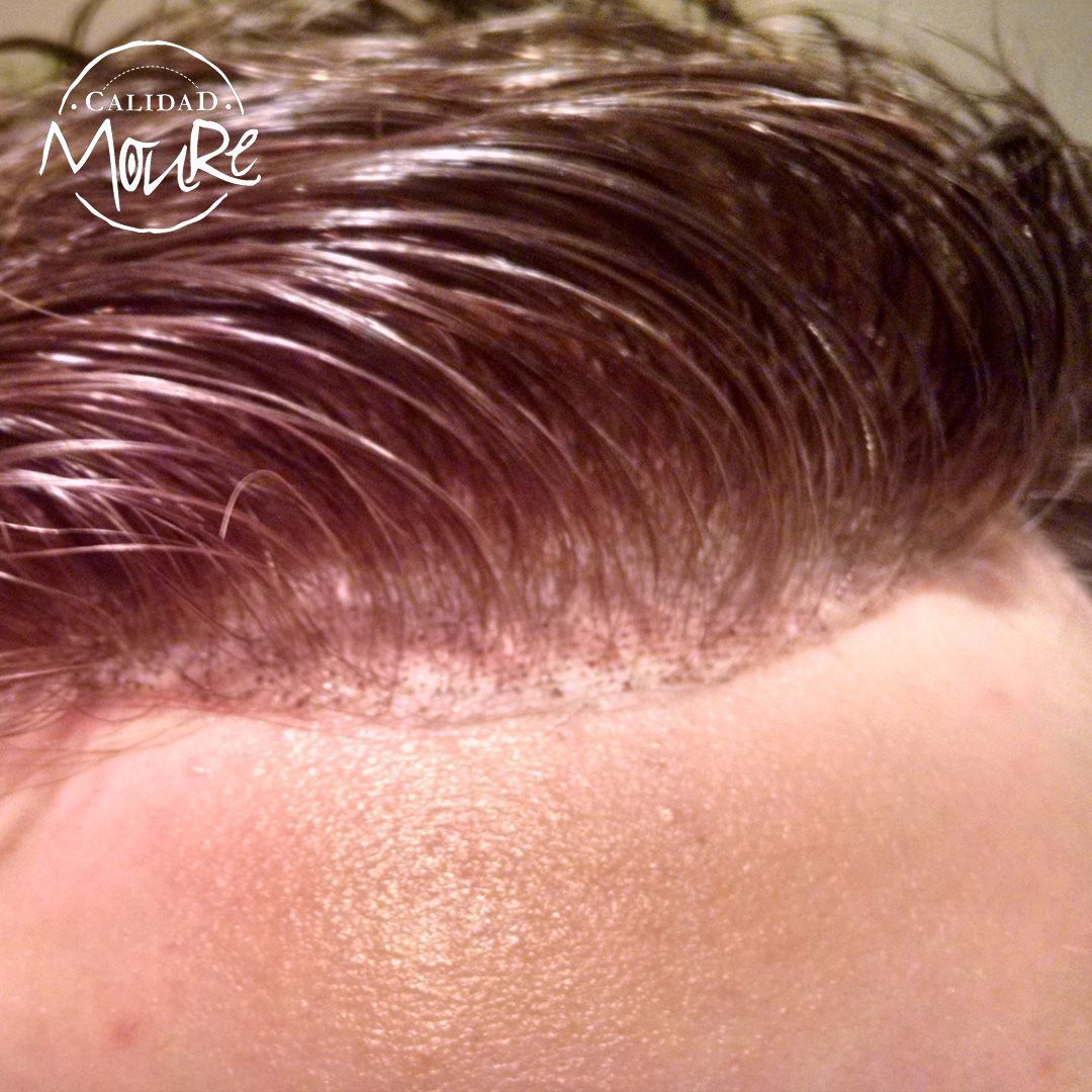 PROTESIS CABALLERO MOURE MALLA SUIZA (6)