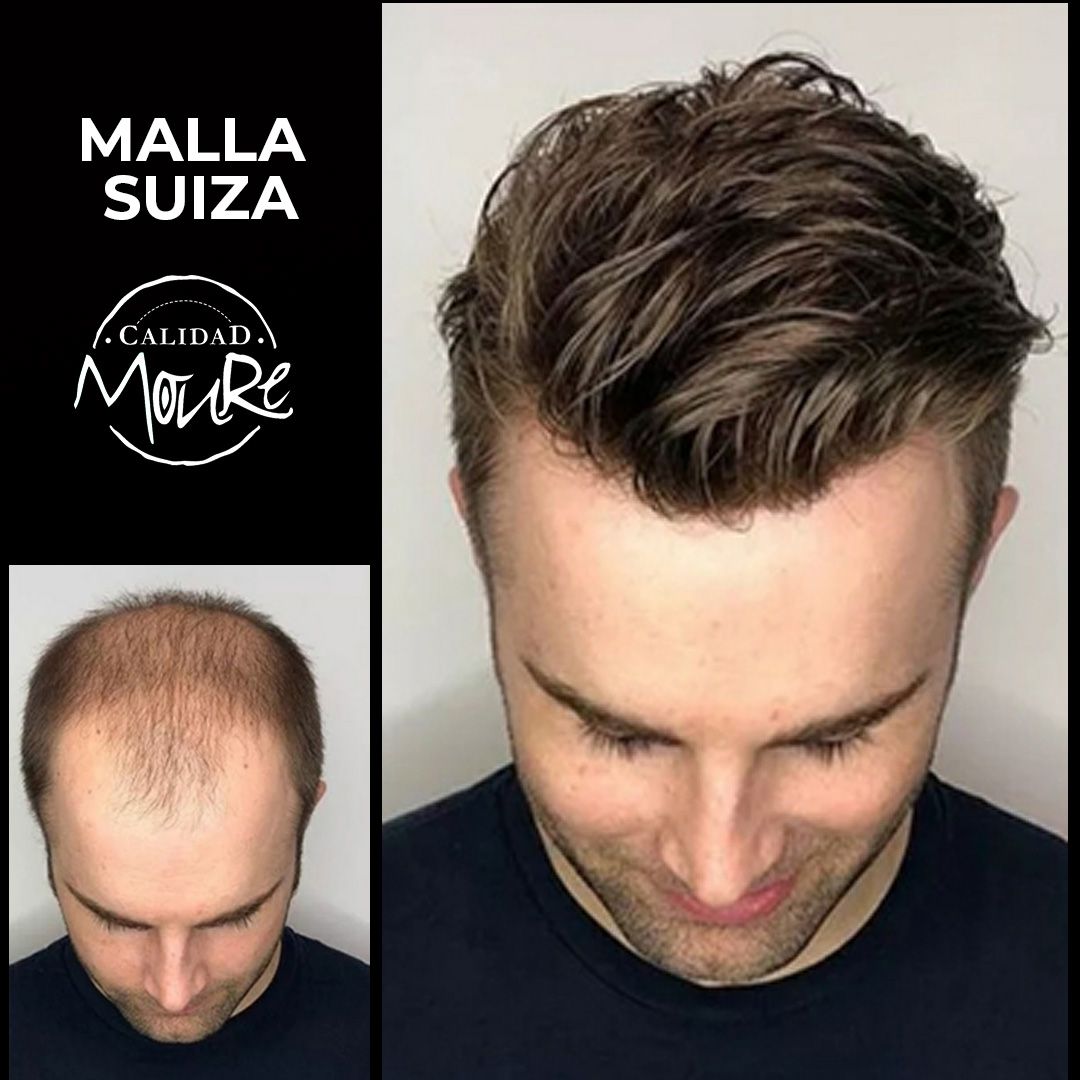 PROTESIS CABALLERO MOURE MALLA SUIZA (9)