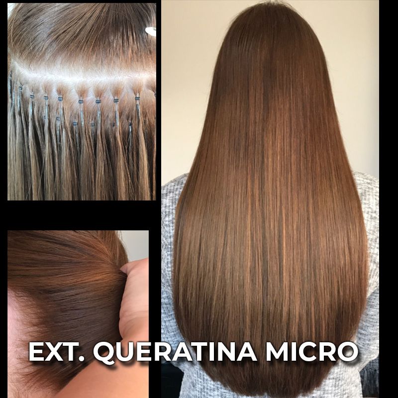 TIPOS DE EXTENSIONES POR SU COLOCACION MOURE (2)
