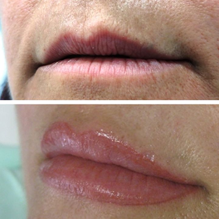Antes y despues micropigmentacion de labios (3)