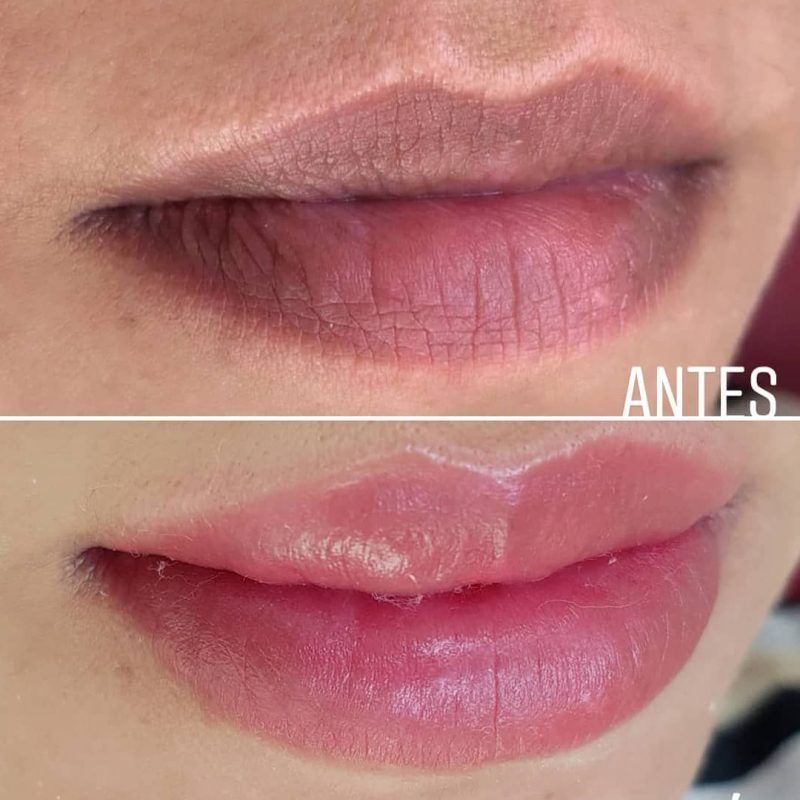 Antes y despues micropigmentacion de labios (6)