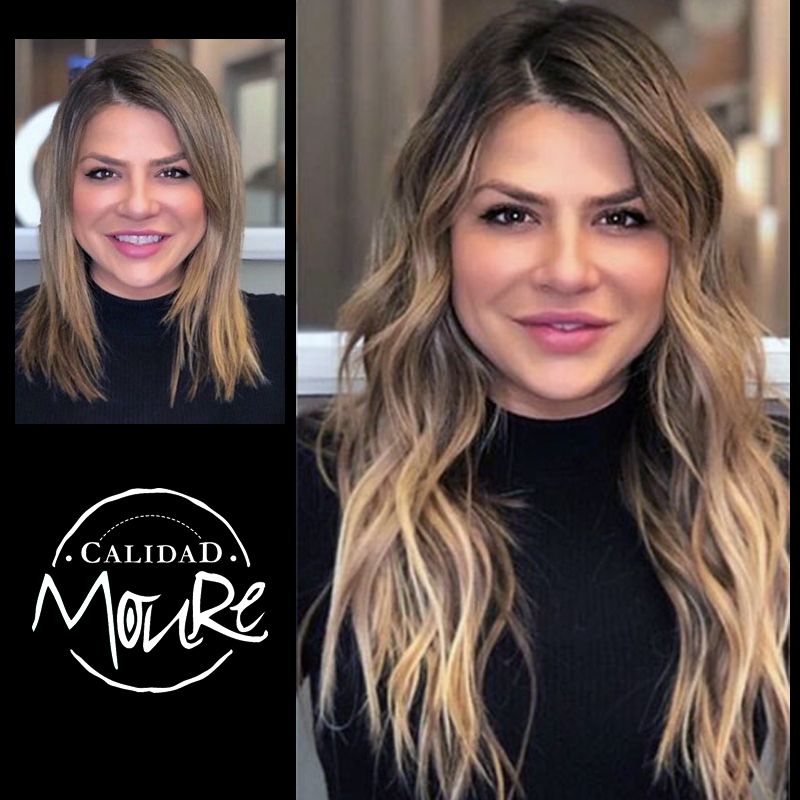 Extensiones antes y despues ,Moure (7)