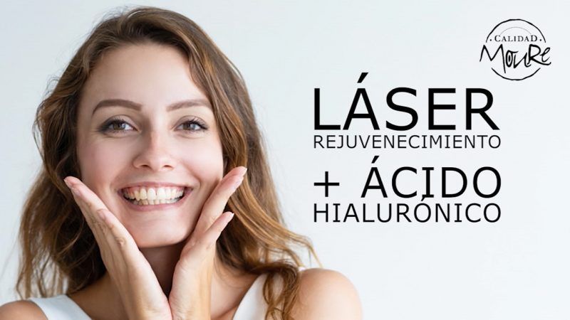 fotorejuvenecimiento facial2