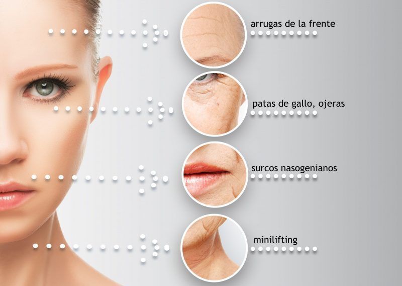 REJUVENECIMIENTO FACIAL MOURE HACIDO HIALURONICO