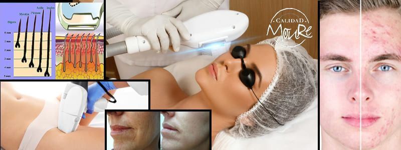 BANNER-LASER-DE-DEPILACION-Y-MAS-MOURE-PALMA-DE-MALLORCA (1)