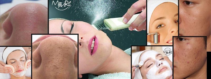 BANNER LIMPIEZA DE CUTIS POR ULTRASONIDOS CENTRO DE ESTETICA MOURE MALLORCA LIMPIEZA FACIAL POR ULTRASONIDOS BANNER MOURE