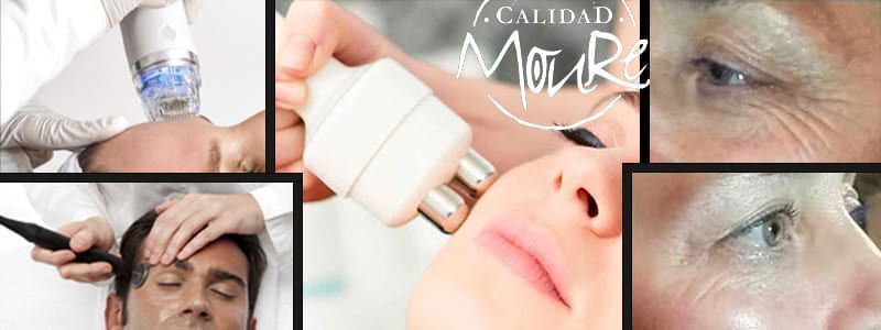 BANNER-RADIOFRECUENCIA-FACIAL-PALMA-DE-MALLORCA-CENTRO-DE-ESTETICA-MOURE (1)