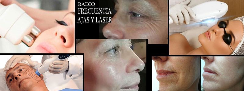 LIMPIEZA FACIAL POR ULTRASONIDOS BANNER MOURE