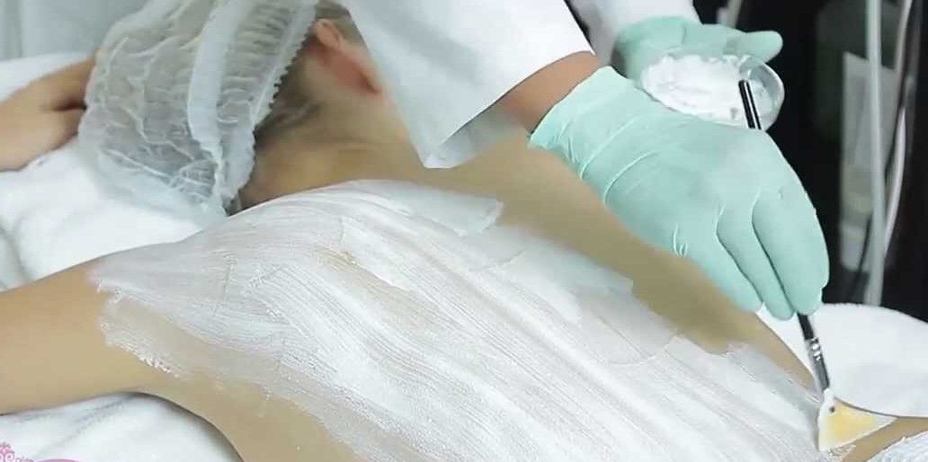 TRATAMIENTO DE ACNE EN LA ESPALDA MALLORCA CENTROS MOURE (4)