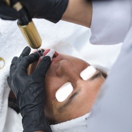 ACIDO HIALURONICO LABIOS, HIALUROPEN PALMA DE MALLORCA CENTROS MOURE (5)