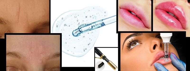 EXTENSIONES Y PROTESIS