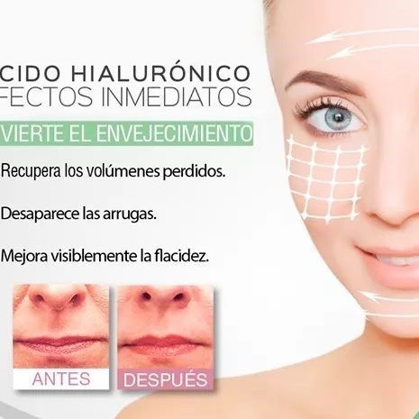 HACIDO HIALURONICO BENEFICIOS . CENTRO DE ESTE TICA MOURE MALLORCA (6)