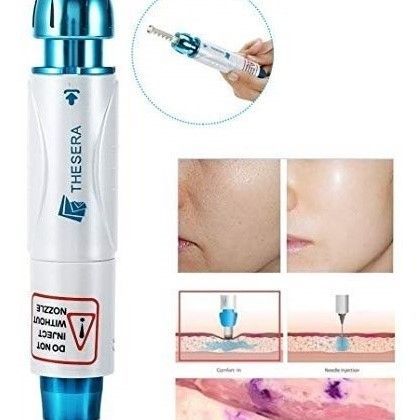 HIALUROPEN , HACIDO HIALURONICO ,ENTRECEJO Y NASOGENIANO,MALLORCA ESTETICA MOURE (6)