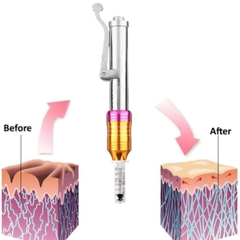 HIALUROPEN TECNICA Y APARATOLOGIA MALLORCA CENTROS MOURE (5)