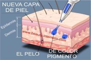 Micropigmentación Capilar Mallorca. OFERTA DE MICROPIGMENTACIÓN CAPILAR POR SOLO 290€ Una sesión de dos horas de Micropigmentación Capilar. Técnica pelo a pelo o punteado.