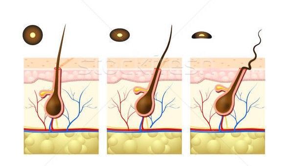 extructura del pelo rizado (2) sirve para ver la seccion diferente de los distintos tipos de pelo rizado ondulado y liso