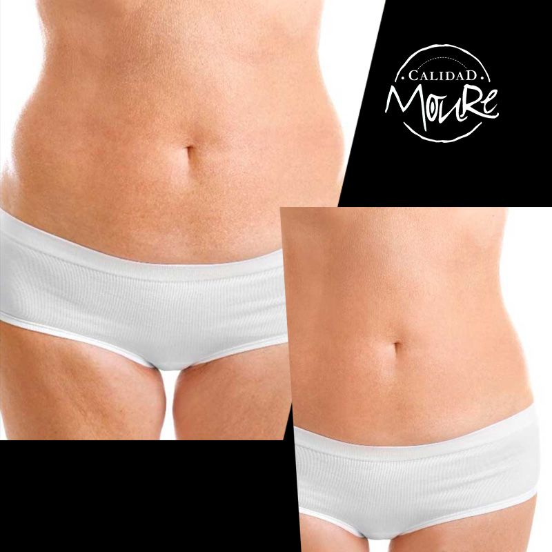 FOTOS DE RESULTADOS ANTES Y DESPUES DE TRATAMIENTO REDUCTOR CORPORAL MOURE MALLORCA (3)