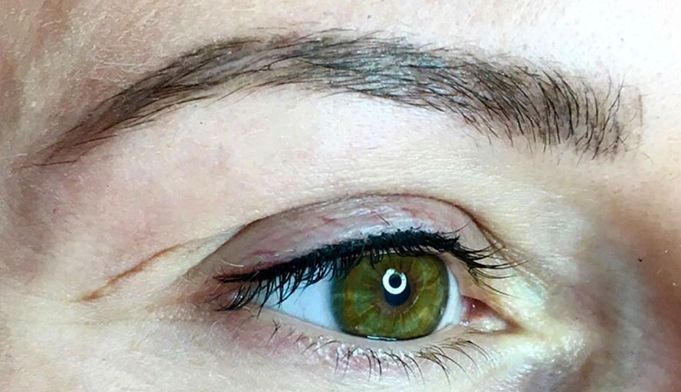 MICROPIGMENTACION DE OJOS Y PESTAÑAS MOURE ANTES Y DESPUES (6)