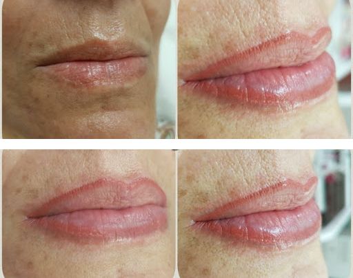 OFERTA DE PERFILADOR DE LABIOS (2)