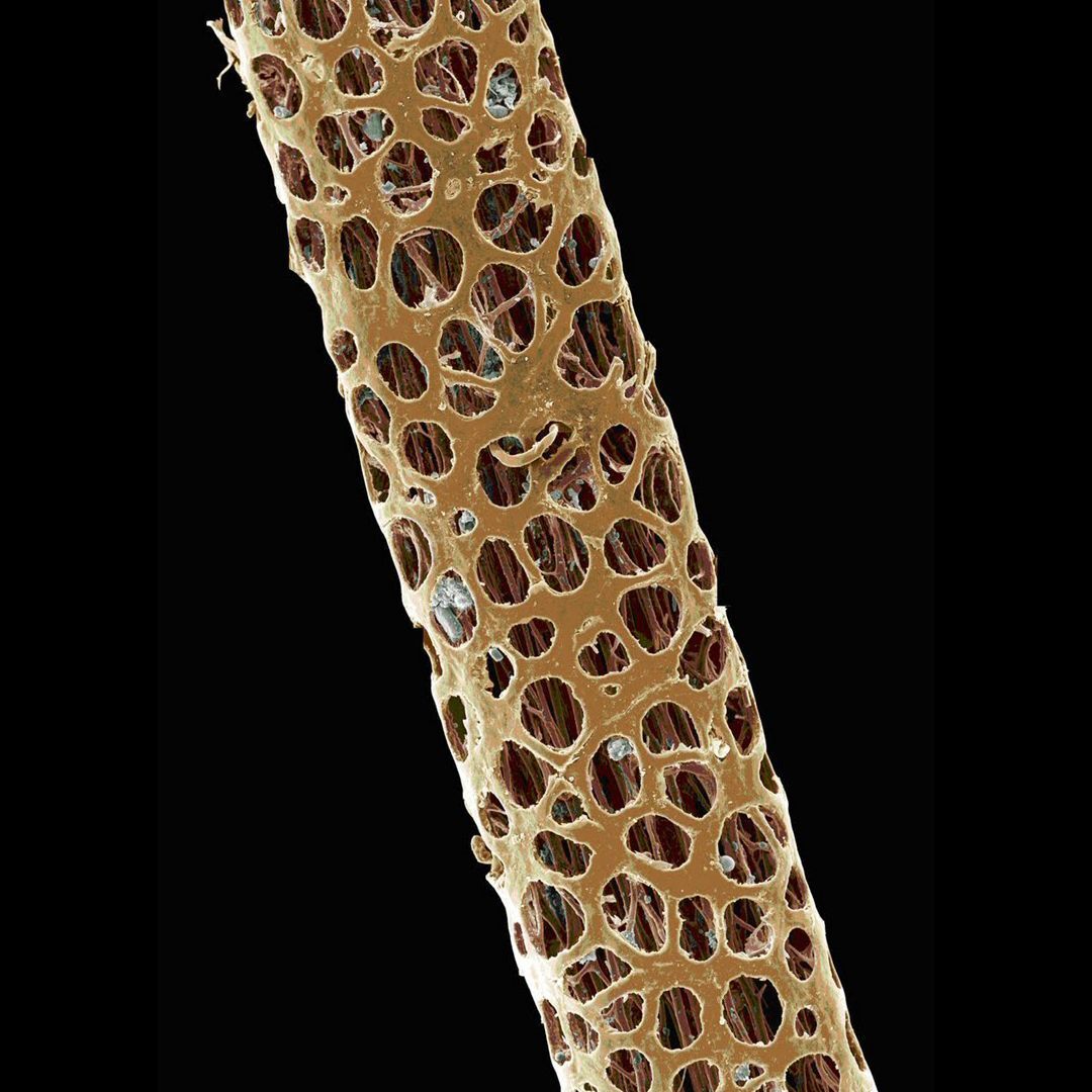 PELO AL MICROSCOPIO (2)