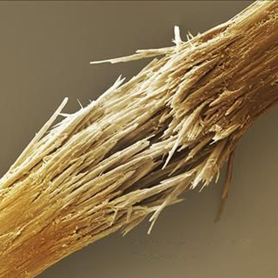 PELO AL MICROSCOPIO (4)