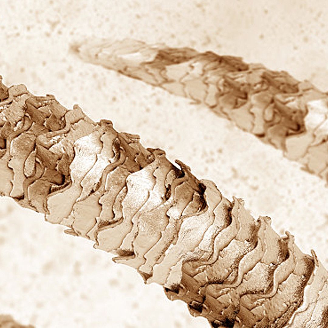 PELO AL MICROSCOPIO (5)