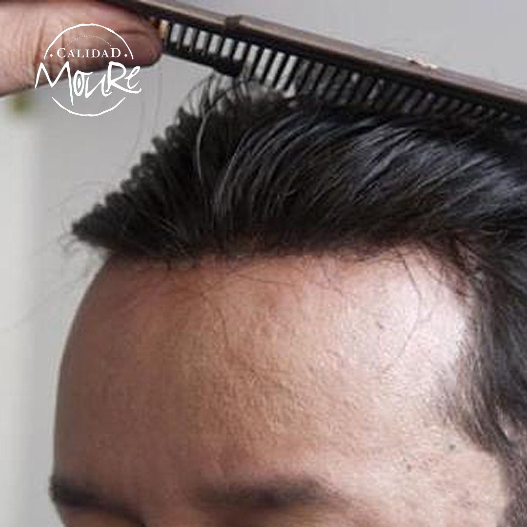 PROTESIS CABALLERO MOURE MALLA SUIZA (5)