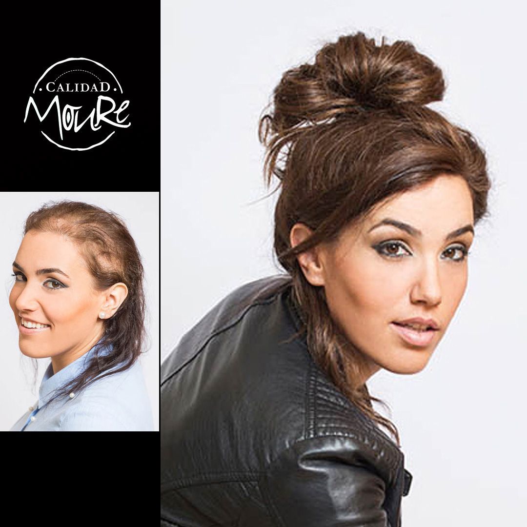 PROTESIS MALLA SUIZA MUJER MOURE (3)