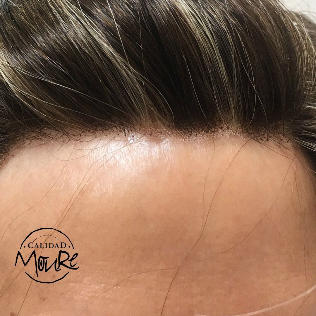 PROTESIS MALLA SUIZA MUJER MOURE (6)