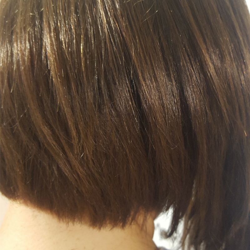 PROTESIS MUJER MOURE (4)