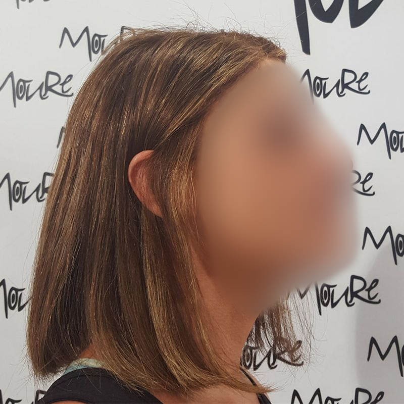 PROTESIS MUJER MOURE (7)