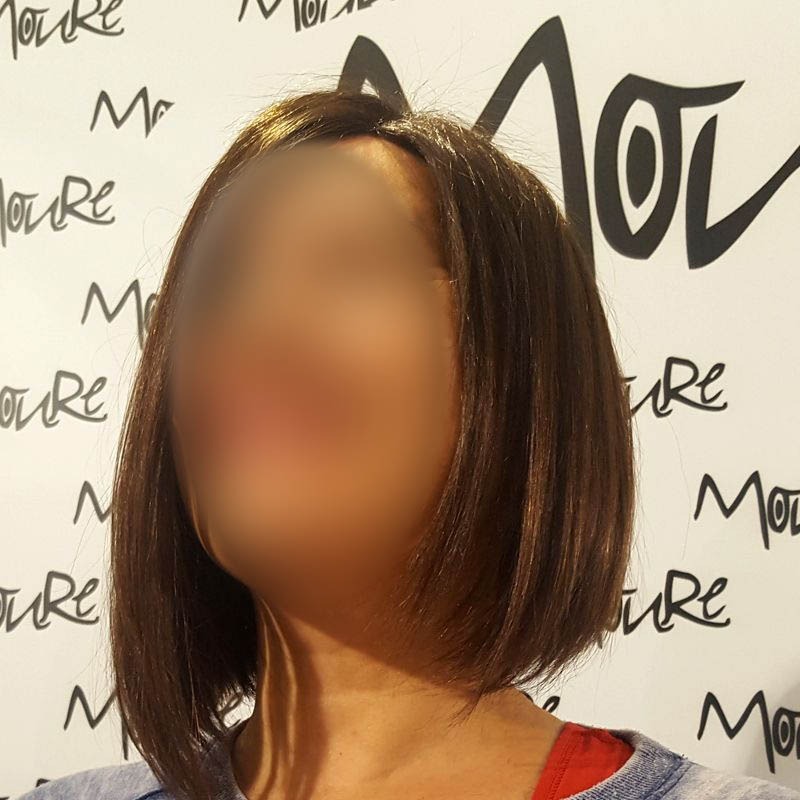 PROTESIS MUJER MOURE (8)