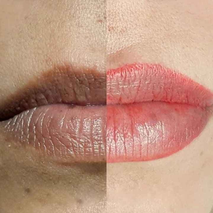 Antes y despues micropigmentacion de labios (4)