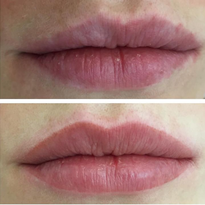 Antes y despues micropigmentacion de labios (5)