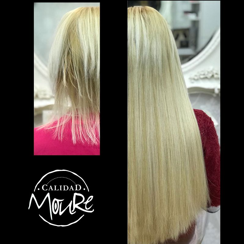 Extensiones antes y despues ,Moure (8)