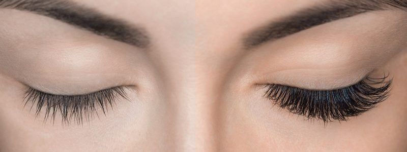 Eyelash Removal Procedure Close Up. Beautiful Woman With Long La EXTENSIONES Y PROTESIS