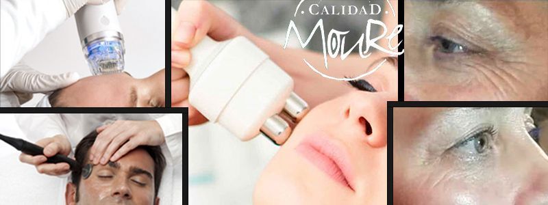 BANNER RADIOFRECUENCIA FACIAL PALMA DE MALLORCA CENTRO DE ESTETICA MOURE PELUQUERIA MALLORCA MOURE