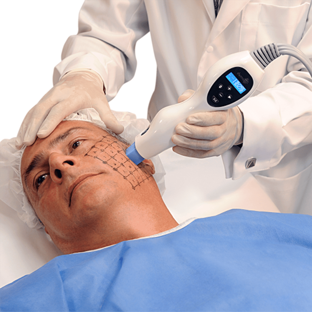 RADIOFRECUENCIA LASER GALVANICA Y ACIDO HIALURONICO CENTRO DE ESTETICA MOURE MALLORCA (1)