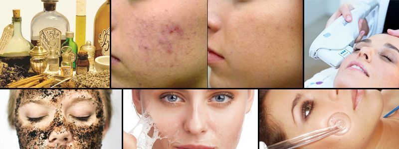 PELUQUERIA MALLORCA MOURE