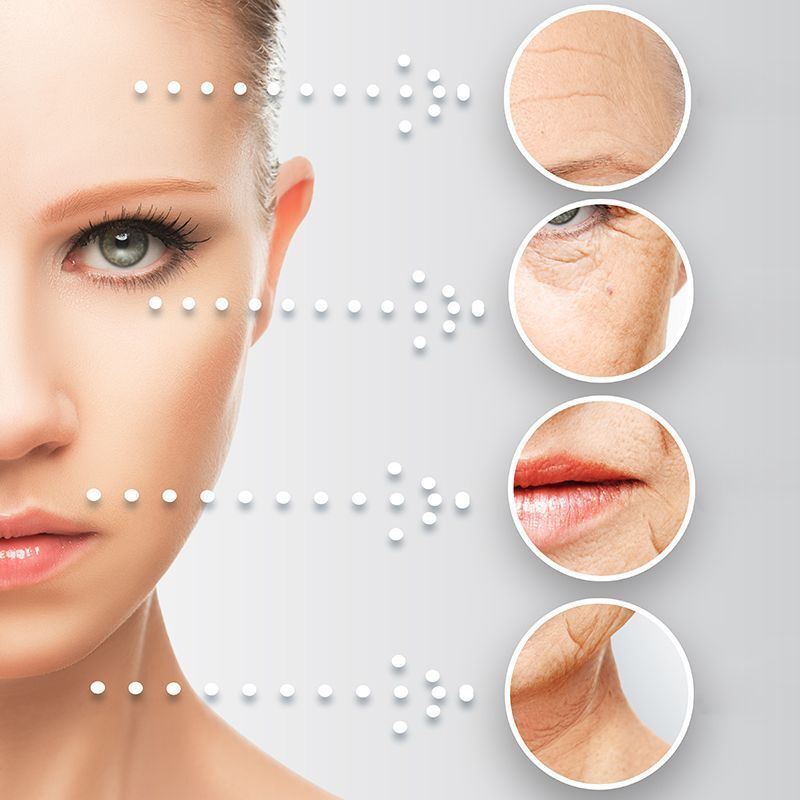 TRATAMIENTO FOTOREJUVENECIMIENTO FACIAL CENTROS MOURE MALLORCA (5)