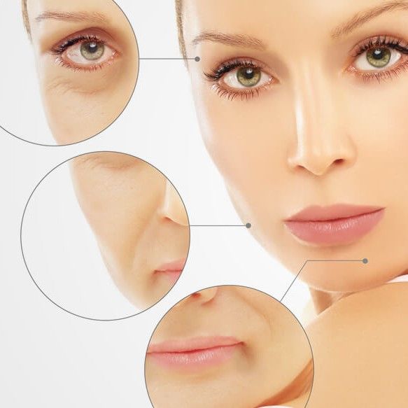 HACIDO HIALURONICO BENEFICIOS . CENTRO DE ESTE TICA MOURE MALLORCA (4)